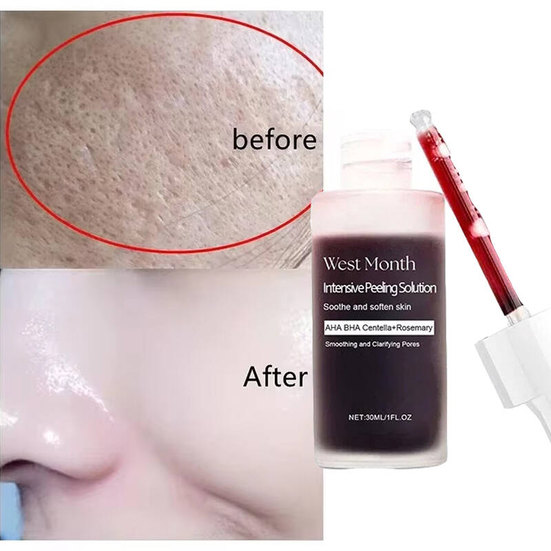 Tranexamic Acid Serum - 실크처럼 부드러워 보이고, 필터처럼 보인다. 살리실산