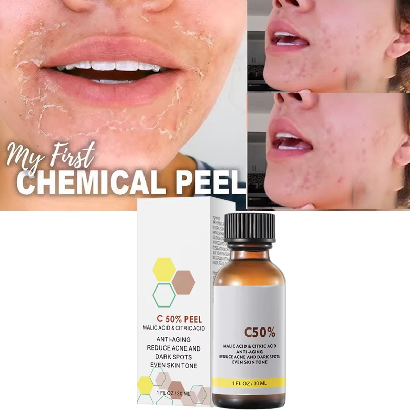 Tranexamic Acid Serum - 사과산과 구연산 함유 40% 필링 세럼,