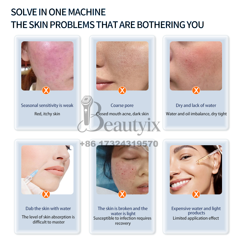 최신형 헬로 페이스 3 고압 에어플로우 수분 공급 페이 - Skincare Ls 리뷰 및 가격