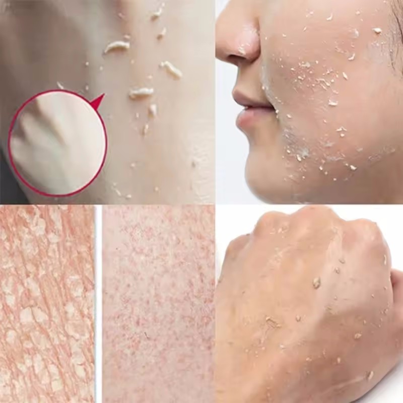 오렌지 엑스 폴리 에이 팅 필링 젤 페이셜 스크럽 모이 - Ceramide Moisturizer 리뷰 및 가격