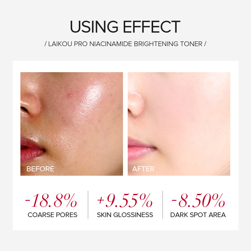 라이코우 프로 나이아신아마이드 4종 브라이트닝 스킨케어 - Skincare Oily Skin 리뷰 및 가격