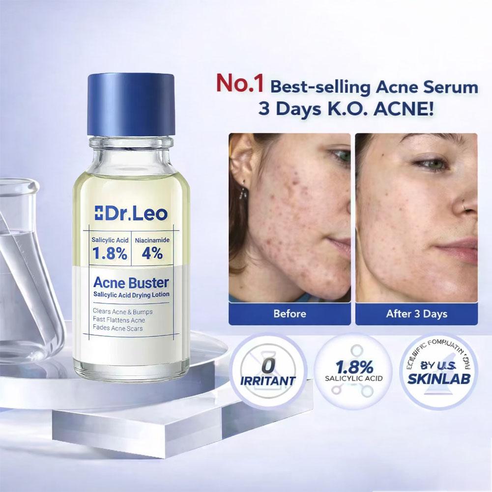 살리실산 에센스 트리트먼트 로션 페이스 세럼 (면봉 포 - Tranexamic Acid Serum 리뷰 및 가격