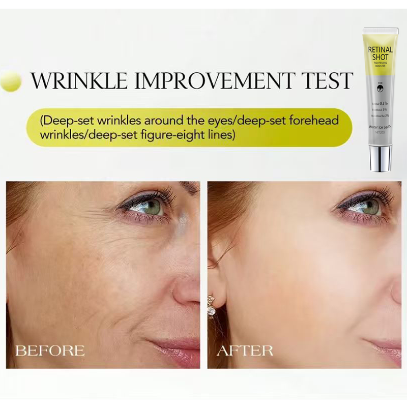 레티날 0.1% 인텐시브 샷 판테놀 1% 히알루론산 3 - Tranexamic Acid Serum 리뷰 및 가격