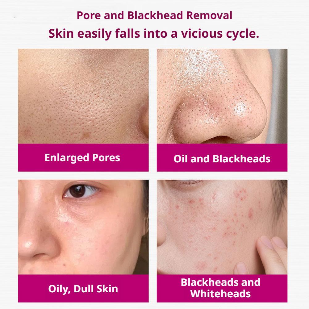 살리실산 모공 축소 세럼 각질 제거 보습 영양 공급 모 - Tranexamic Acid Serum 리뷰 및 가격