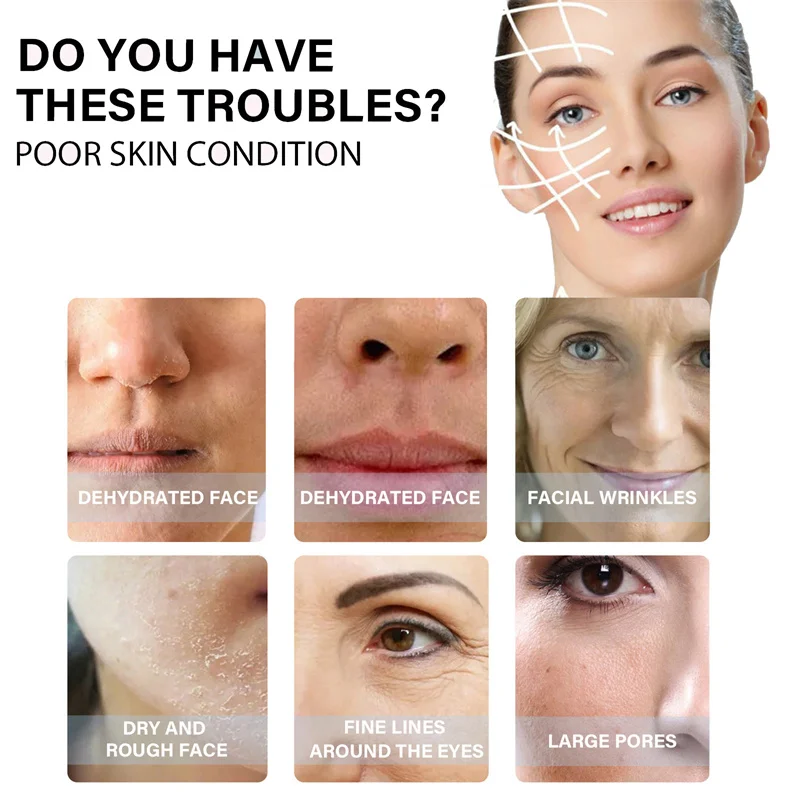단백질 스레드 리프팅 키트 페이스 리프트 퍼밍 흡수성  - Skincare Garnier 리뷰 및 가격