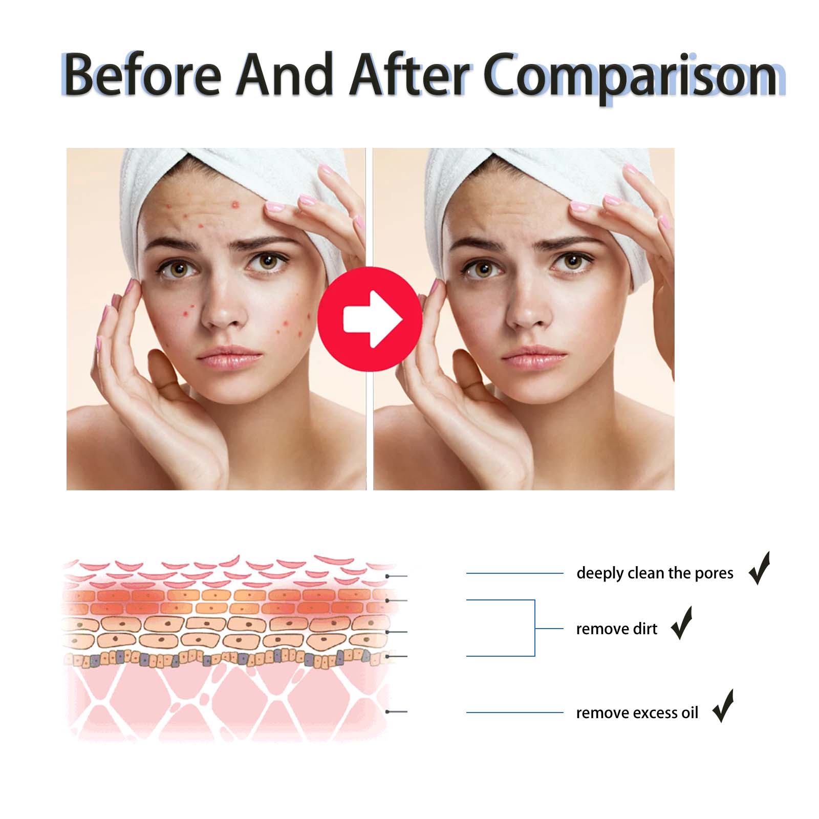 2% 살리실산 액상 각질 제거제 모공 축소 세럼, 확대 - Tranexamic Acid Serum 리뷰 및 가격
