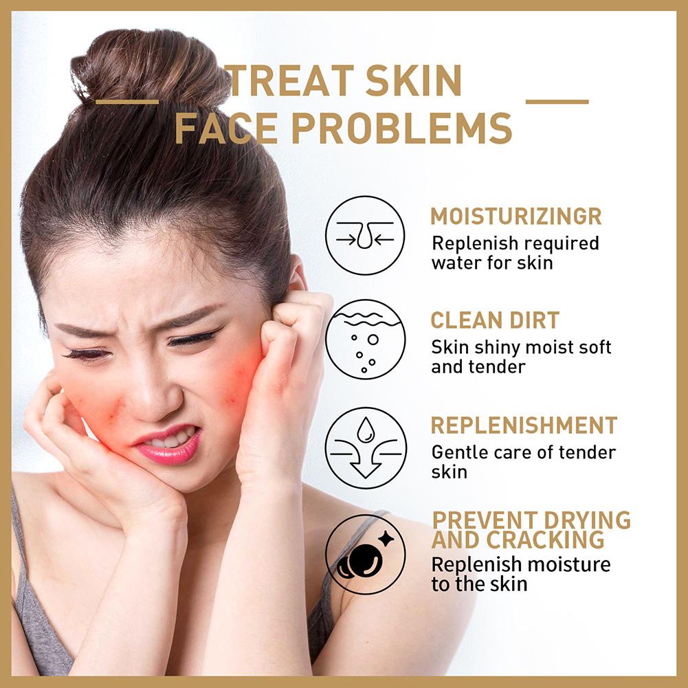 라이스 토너 영양 모이스춰 라이징 워터 스무딩 피부 장 - Skincare Garnier 리뷰 및 가격
