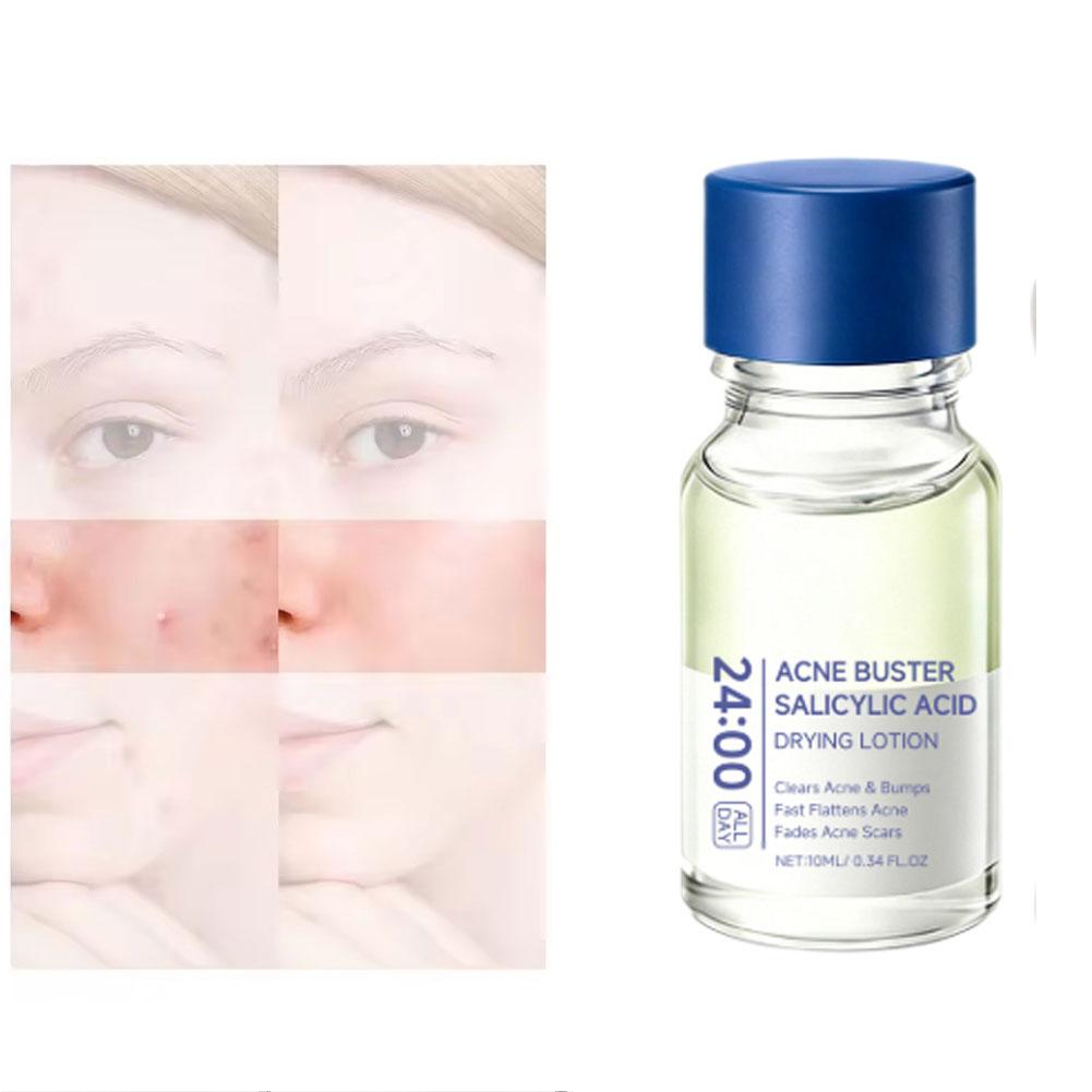 살리실산 에센스 트리트먼트 로션 드라잉 로션 페이스 세 - Tranexamic Acid Serum 리뷰 및 가격