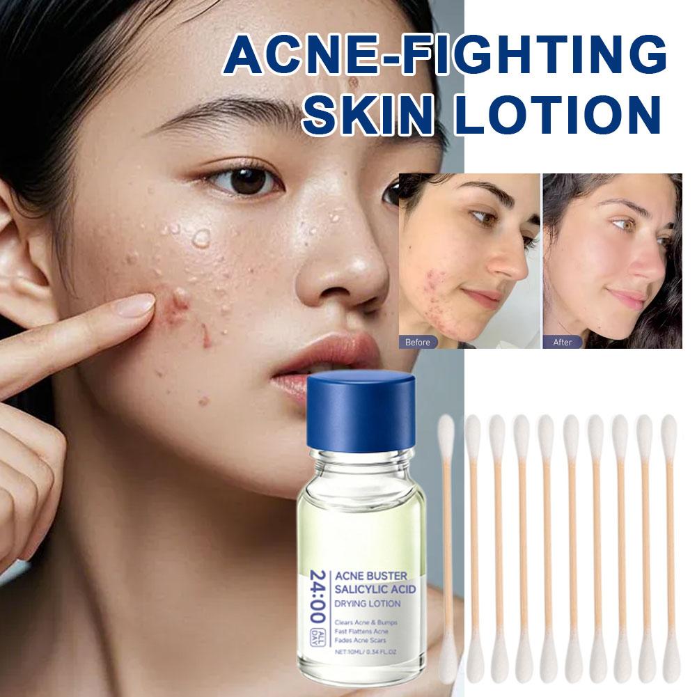 살리실산 에센스 트리트먼트 로션 드라잉 로션 페이스 세 - Tranexamic Acid Serum 리뷰 및 가격