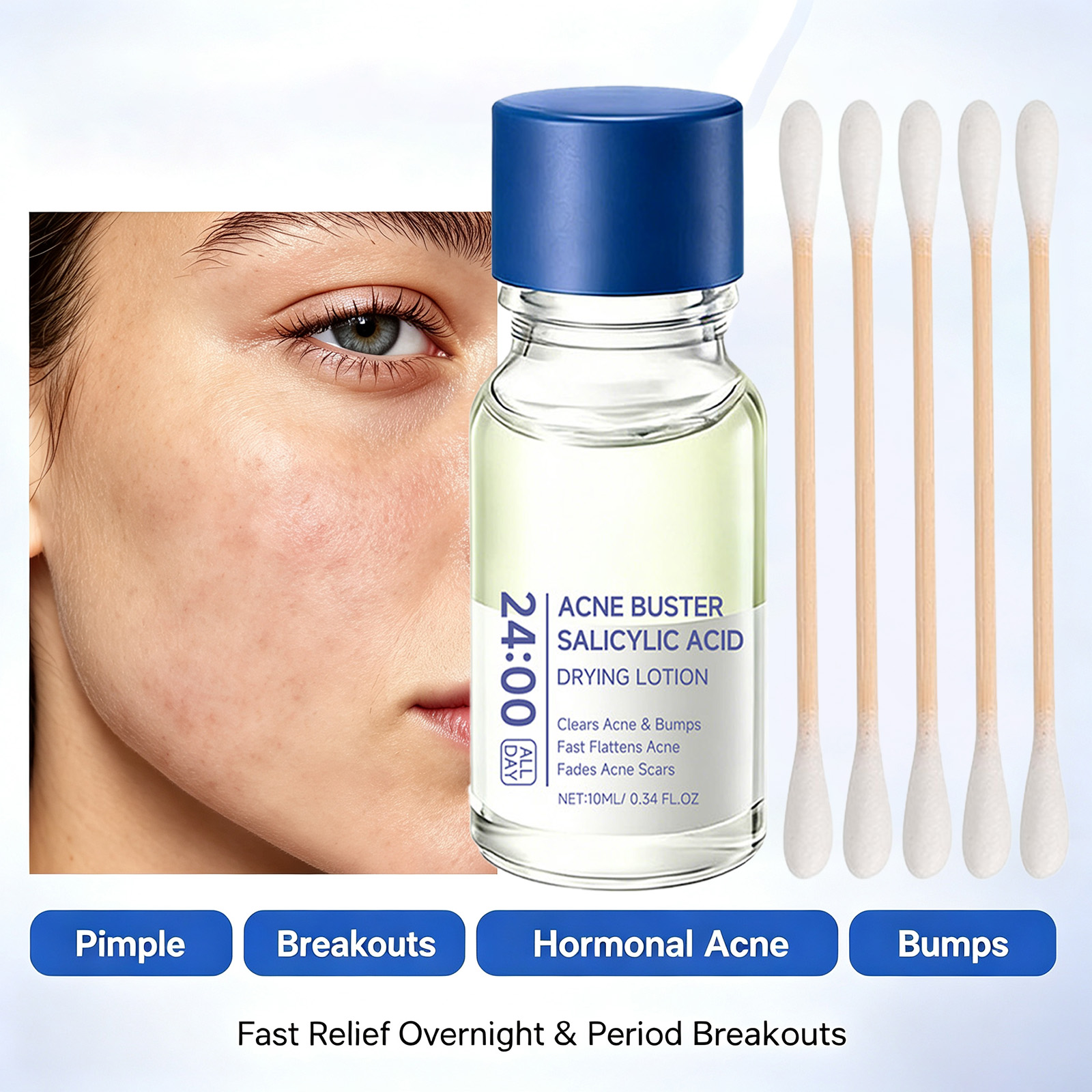 살리실산 여드름 치료 세럼, 나이아신아마이드 함유, 여 - Tranexamic Acid Serum 리뷰 및 가격