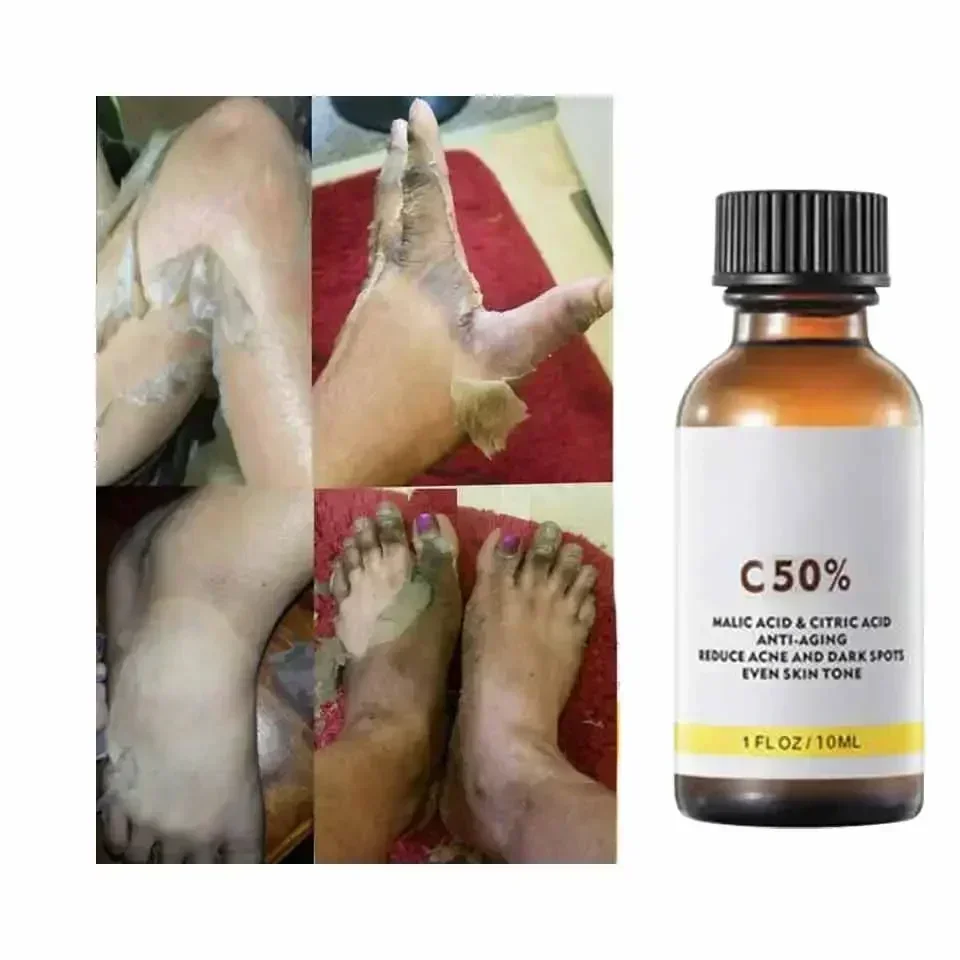 사과산과 구연산 함유 40% 필링 세럼, 화학 필링,  - Tranexamic Acid Serum 리뷰 및 가격